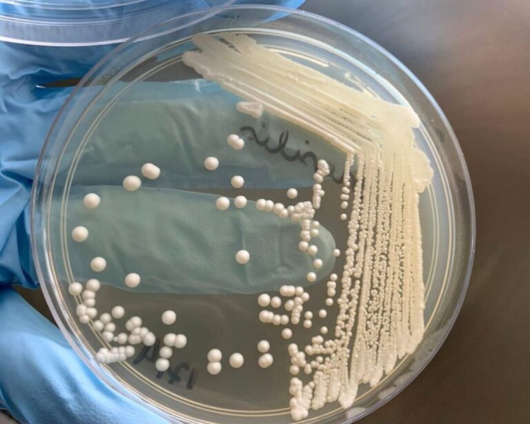 Levedura inédita ganha uso comercial e reforça busca por perfil brasileiro